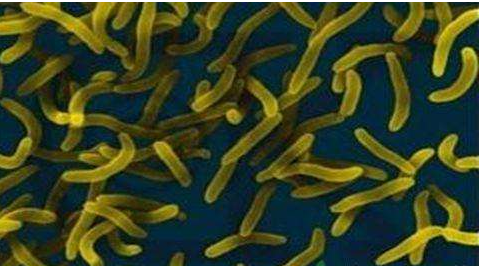 微生物菌劑好？好在哪里您知道嗎？